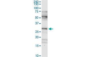 FHL2 MaxPab rabbit polyclonal antibody. (FHL2 抗体  (AA 1-279))