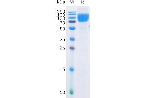 SDS-PAGE (SDS) image for CD86 (CD86) (AA 26-247) protein (mFc-His Tag) (ABIN6961107)