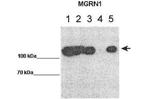WB Suggested Anti-MGRN1 Antibody    Positive Control:  Lane 1: 10ug MGRN1-GFP transfected HEK293T Lane 2: 10ug mut1MGRN1-GFP transfected HEK293T Lane 3: 10ug mut1MGRN2-GFP transfected HEK293T Lane 4: 10ug GFP transfected HEK293T Lane 5: 10ug IP for GFP using lysate from lane 1   Primary Antibody Dilution :   1:1000   Secondary Antibody :  Goat anti rabbit-HRP   Secondry Antibody Dilution :   1:50,000  Submitted by:  Teresa Gunn, McLaughin Research Institute MGRN1 is supported by BioGPS gene expression data to be expressed in HEK293T (Mahogunin RING Finger Protein 1 抗体  (Middle Region))