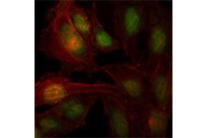Immunofluorescence analysis of Hela cells using ZBTB7B mouse mAb (green). (ZBTB7B 抗体)