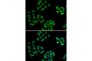 Immunofluorescence analysis of HeLa cell using NSFL1C antibody. (NSFL1C 抗体)