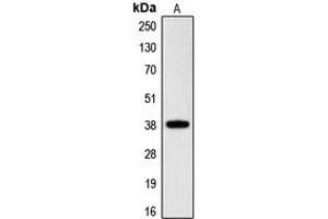Western blot analysis of RNF197 expression in HeLa (A) whole cell lysates. (CGR19 抗体  (C-Term))
