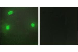 Immunofluorescence analysis of HeLa cells, using FEN1 antibody. (FEN1 抗体)