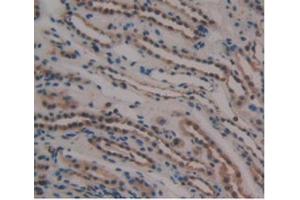 Detection of GDF3 in Human Kidney Tissue using Monoclonal Antibody to Growth Differentiation Factor 3 (GDF3) (GDF3 抗体  (AA 251-364))