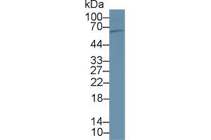 Detection of PCSK9 in Rat Liver lysate using Polyclonal Antibody to Proprotein Convertase Subtilisin/Kexin Type 9 (PCSK9) (PCSK9 抗体  (AA 164-428))