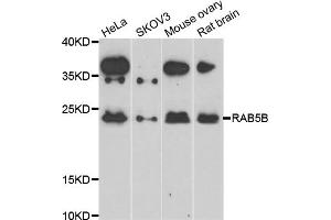 Western blot analysis of extracts of various cell lines, using RAB5B antibody (ABIN5975540) at 1/1000 dilution. (RAB5B 抗体)