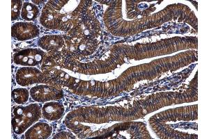 IHC-P Image ARL14 antibody [N1C3] detects ARL14 protein at cytoplasm and membrane in mouse duodenum by immunohistochemical analysis. (ARL14 抗体  (full length))