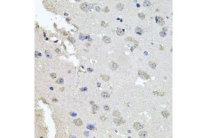 Immunohistochemistry of paraffin-embedded mouse brain using PKN1 antibody. (PKN1 抗体  (AA 1-300))