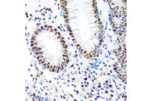 Immunohistochemistry (IHC) image for anti-Polybromo 1 (PBRM1) antibody (ABIN1512585)