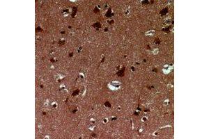 Immunohistochemical analysis of EID1 staining in human brain formalin fixed paraffin embedded tissue section. (EID1 抗体)