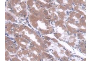 Detection of CBFb in Human Stomach Tissue using Polyclonal Antibody to Core Binding Factor Beta Subunit (CBFb)