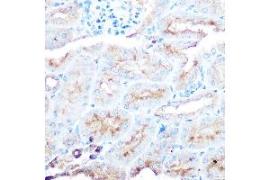 Immunohistochemistry of paraffin-embedded human liver using ZIP14 Rabbit pAb (ABIN6133191, ABIN6147993, ABIN6147994 and ABIN6214658) at dilution of 1:50 (40x lens). (SLC39A14 抗体  (AA 240-340))