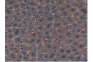 IHC-P analysis of Mouse Liver Tissue, with DAB staining. (FLT4 抗体  (AA 30-326))