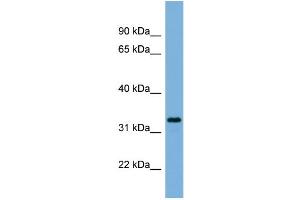WB Suggested Anti-PEX11A  Antibody Titration: 0. (PEX11A 抗体  (N-Term))