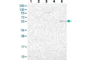 Western blot analysis of Lane 1: RT-4, Lane 2: U-251 MG, Lane 3: Human Plasma, Lane 4: Liver, Lane 5: Tonsil with PSAPL1 polyclonal antibody  at 1:250-1:500 dilution. (PSAPL1 抗体)