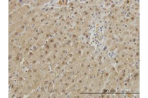Immunoperoxidase of monoclonal antibody to GSTA1 on formalin-fixed paraffin-embedded human liver. (GSTA1 抗体  (AA 1-222))