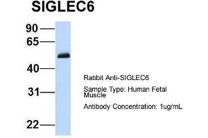 Host:  Rabbit  Target Name:  SIGLEC6  Sample Type:  Human Fetal Muscle  Antibody Dilution:  1. (SIGLEC6 抗体  (N-Term))
