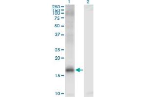 Western Blot analysis of JARID1A expression in transfected 293T cell line by JARID1A monoclonal antibody (M03), clone 1H2. (KDM5A 抗体  (AA 191-290))
