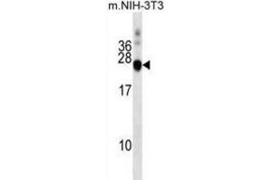 Western Blotting (WB) image for anti-DnaJ (Hsp40) Homolog, Subfamily C, Member 5 (DNAJC5) antibody (ABIN2999623) (DNAJC5 抗体)