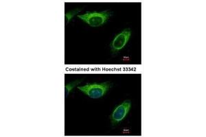 ICC/IF Image Immunofluorescence analysis of methanol-fixed HeLa, using MEK2, antibody at 1:500 dilution. (MEK2 抗体)