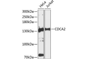 Western blot analysis of extracts of various cell lines, using CDC antibody (ABIN6131118, ABIN6138269, ABIN6138270 and ABIN6224963) at 1:3000 dilution. (CDCA2 抗体  (AA 724-1023))