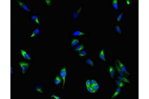 Immunofluorescent analysis of Hela cells using ABIN7145558 at dilution of 1:100 and Alexa Fluor 488-congugated AffiniPure Goat Anti-Rabbit IgG(H+L) (COASY 抗体  (AA 453-546))