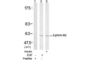 Image no. 1 for anti-Ephrin B2 (EFNB2) (Tyr316) antibody (ABIN197416) (Ephrin B2 抗体  (Tyr316))
