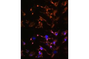 Immunofluorescence analysis of U-251 MG cells using AMPH Rabbit pAb (ABIN6127430, ABIN6136846, ABIN6136847 and ABIN6221037) at dilution of 1:100 (40x lens). (Amphiphysin 抗体  (AA 340-620))