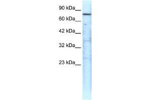 WB Suggested Anti-TRAP1 Antibody Titration: 0. (TRAP1 抗体  (N-Term))