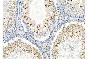 ABIN6265308 and ABIN6273168 at 1/100 staining Rat testis tissue by IHC-P.