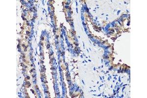 Immunohistochemistry of paraffin-embedded Rat lung using SCGB1A1 Polyclonal Antibody at dilution of 1:100 (40x lens). (SCGB1A1 抗体)