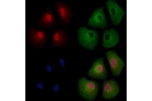 CBX4 Antibody staining A549 cells by IF/ICC. (CBX4 抗体  (Internal Region))