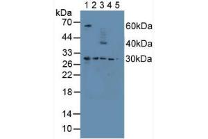 Figure. (Proteasome 26S Subunit, Non ATPase 9 (AA 2-223) 抗体)