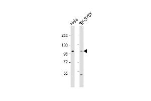 All lanes : Anti-ADCY5 Antibody (Center) at 1:1000-1:2000 dilution Lane 1: Hela whole cell lysate Lane 2: SH-SY5Y whole cell lysate Lysates/proteins at 20 μg per lane. (ADCY5 抗体  (AA 604-639))