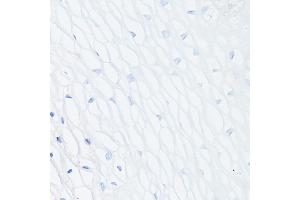 Immunohistochemistry of paraffin-embedded Human normal uterus (negative control sample) using MUC1 Rabbit mAb (ABIN7268687) at dilution of 1:100 (40x lens). (MUC1 抗体)