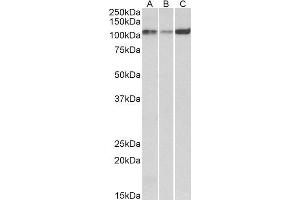 Western Blotting (WB) image for anti-ATPase, Ca++ Transporting, Cardiac Muscle, Slow Twitch 2 (ATP2A2) (Internal Region) antibody (ABIN1686784)