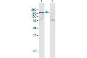 Western Blotting (WB) image for anti-SWI/SNF Related, Matrix Associated, Actin Dependent Regulator of Chromatin, Subfamily A, Member 5 (SMARCA5) (AA 1-1052) antibody (ABIN521925)