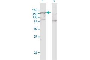 Western Blot analysis of SMARCA5 expression in transfected 293T cell line by SMARCA5 MaxPab polyclonal antibody. (SMARCA5 抗体  (AA 1-1052))