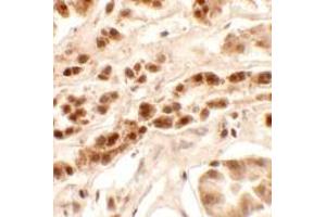 Immunohistochemistry (IHC) image for anti-Patched Domain Containing 2 (PTCHD2) (Middle Region) antibody (ABIN1031050) (PTCHD2 抗体  (Middle Region))
