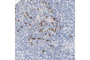 Immunohistochemical staining of human lymph node with GZMB polyclonal antibody  shows strong cytoplasmic positivity in a subset of lymphoid cells outside reaction center at 1:50-1:200 dilution. (GZMB 抗体)