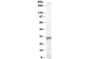 Western blot testing of human muscle lysate with EGLN3 antibody at 0. (EGLN3 抗体)
