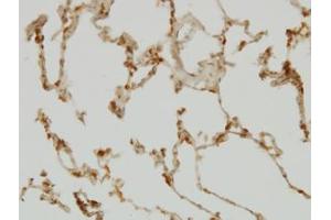 Image no. 4 for anti-SH2 Domain Containing 4A (SH2D4A) (AA 239-338) antibody (ABIN599292) (SH2D4A 抗体  (AA 239-338))
