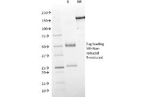 SDS-PAGE Analysis Purified GAD1 (GAD67) Mouse Monoclonal Antibody (GAD1/2563). (GAD 抗体  (AA 72-135))