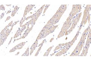 Immunohistochemistry (IHC) image for anti-CD274 (PD-L1) (AA 34-241) antibody (ABIN7428623)
