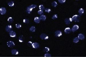 Immunofluorescent staining of Jurkat cells.