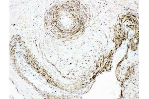 Anti-Monoamine Oxidase A antibody, IHC(P) IHC(P): Human Placenta Tissue (Monoamine Oxidase A 抗体  (N-Term))