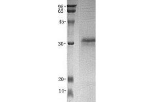 Western Blotting (WB) image for Cysteine-Rich Secretory Protein 3 (CRISP3) (Transcript Variant 2) protein (His tag) (ABIN2712559)