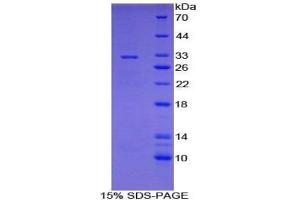 SDS-PAGE (SDS) image for Cytochrome P450, Family 7, Subfamily A, Polypeptide 1 (CYP7A1) protein (ABIN3009117)