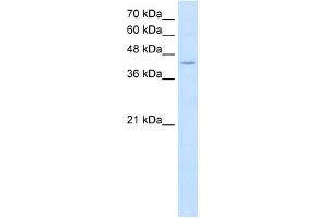 FADS1 antibody used at 2. (FADS1 抗体  (C-Term))