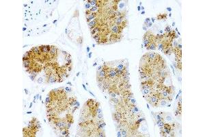 Immunohistochemistry of paraffin-embedded Human stomach using C8orf4 Polyclonal Antibody at dilution of 1:100 (40x lens). (C8orf4 抗体)